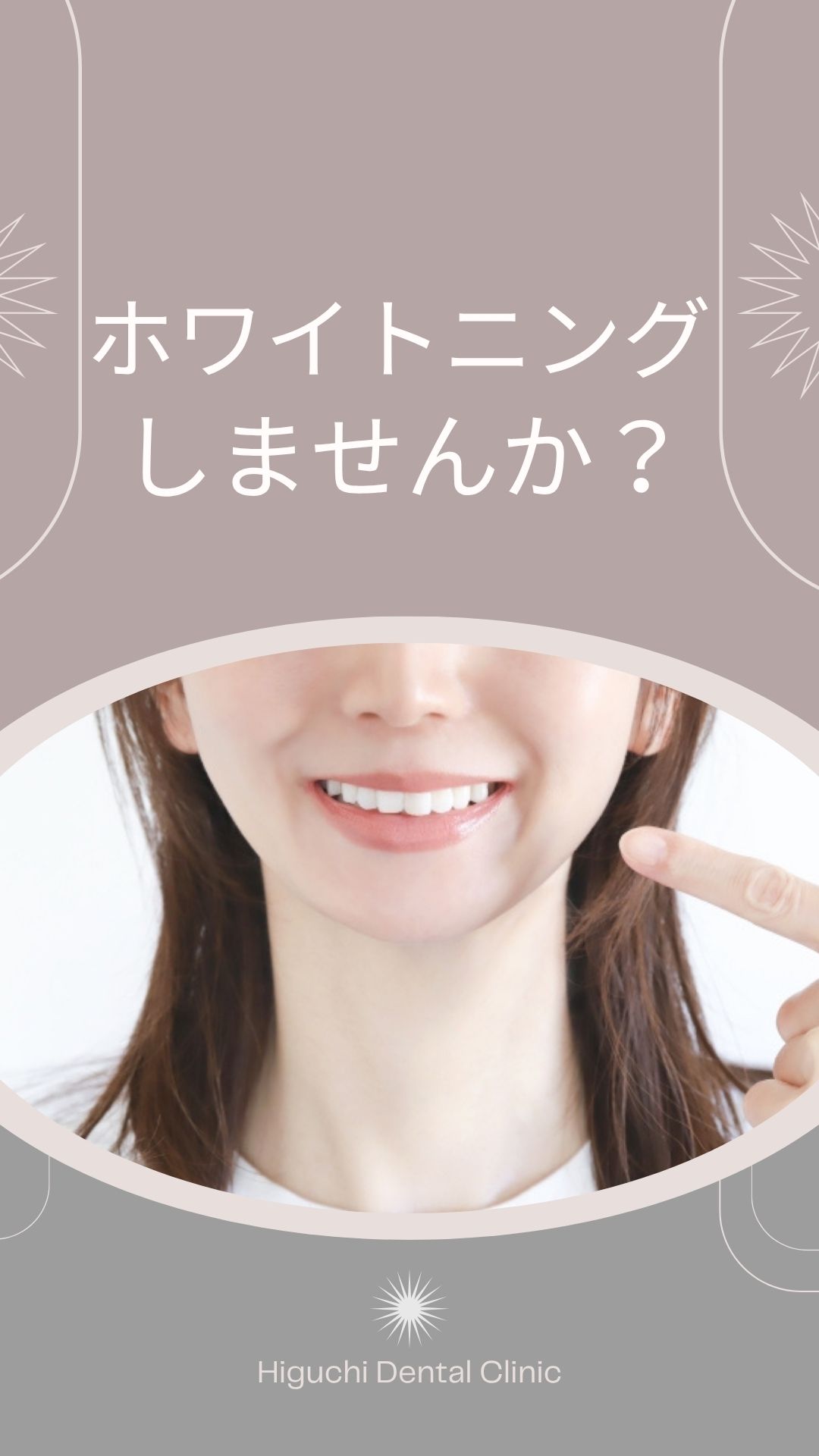 ホワイトニング・ホームホワイトニングについて・YouTube動画への誘導サムネイル